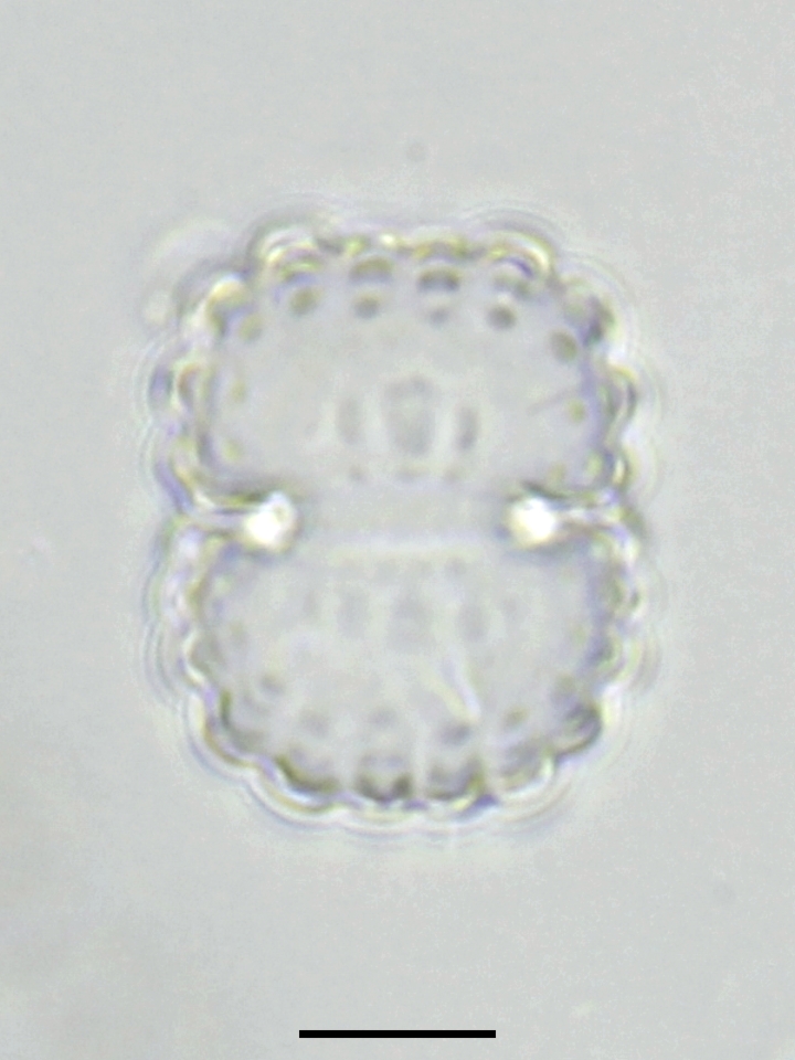Cosmarium neocrenatum